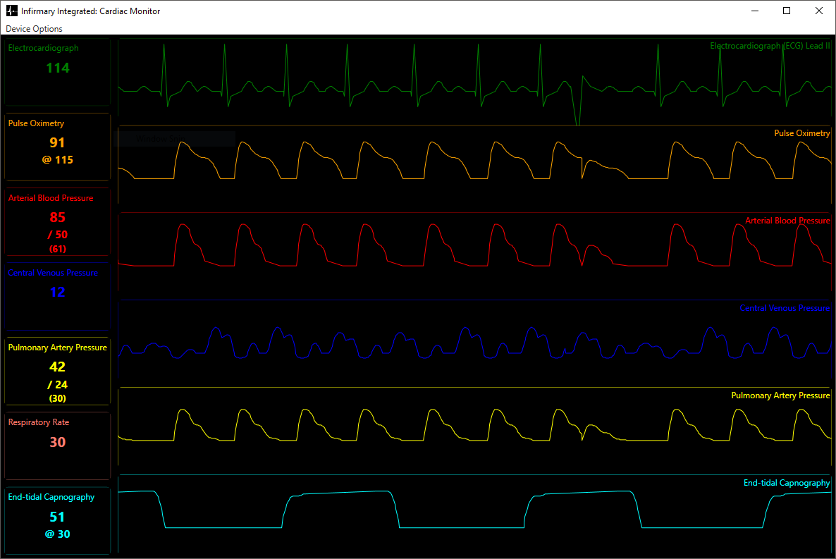 Infirmary Integrated Cardiac Monitor