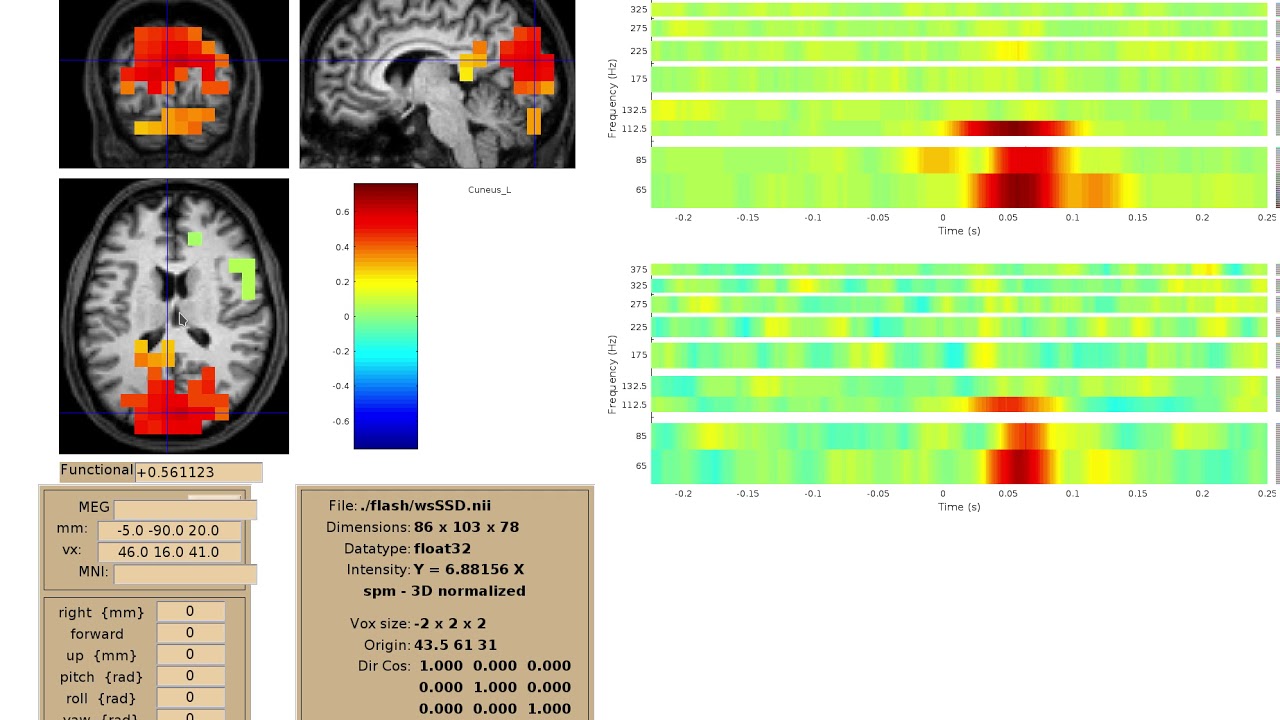 NutmegTrip source-time-frequency viewer example