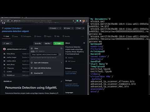 Pneumonia Detection using EdgeML - Cloning and running locally