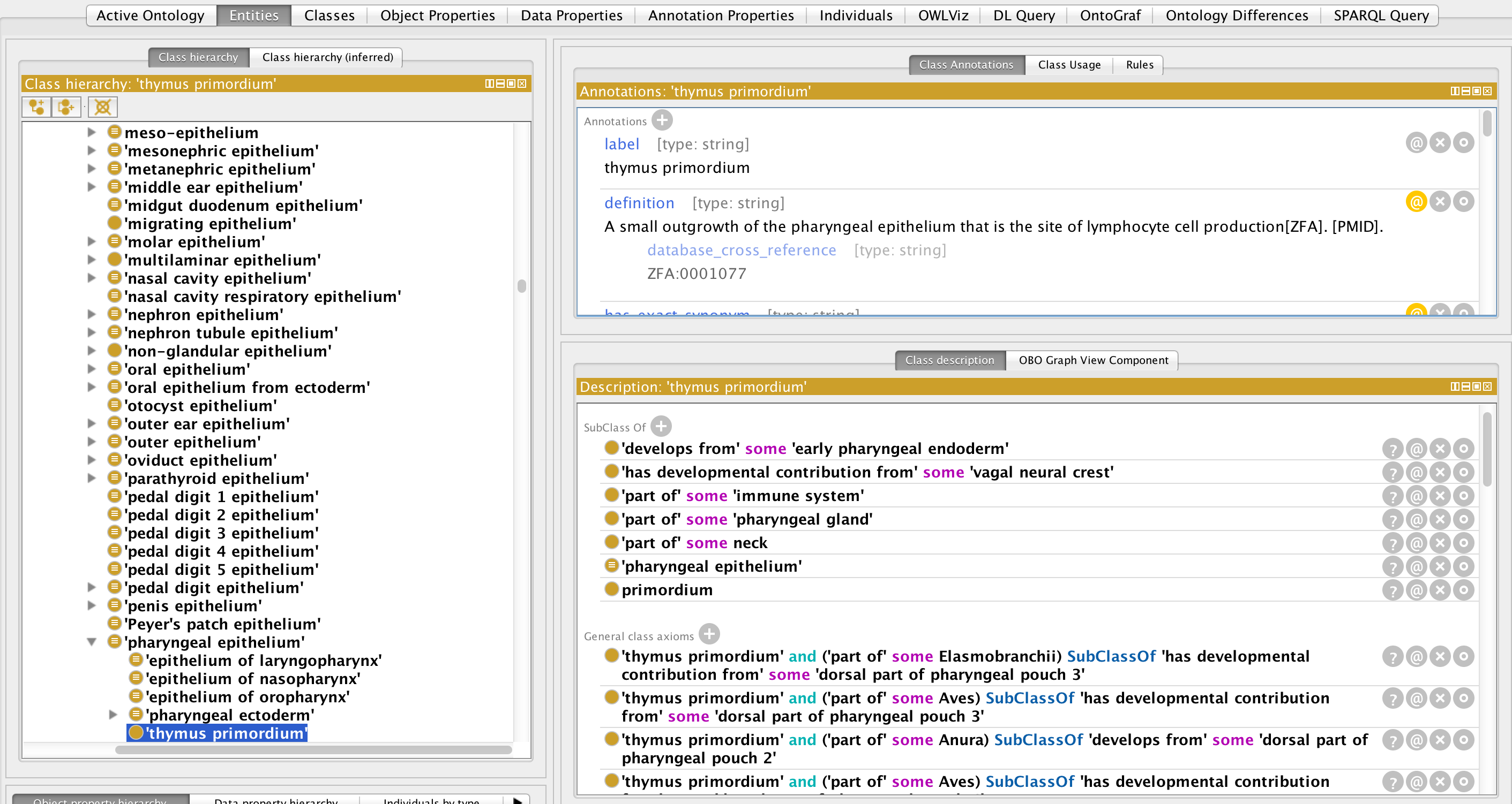 Protege screenshot of thymus primordium