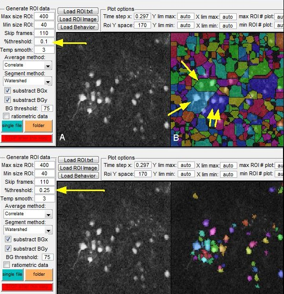 MATLAB Calcium Signal Extract ROI1