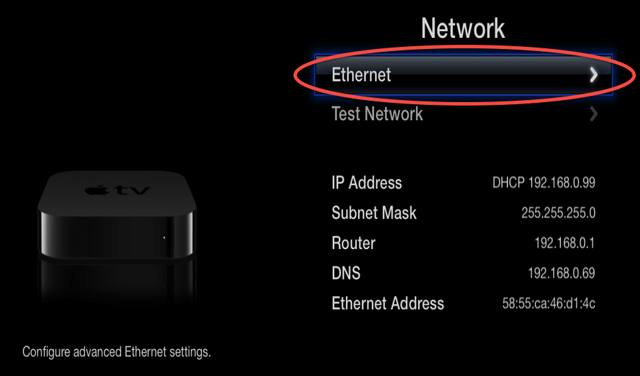 5.2 select network connection ethernet