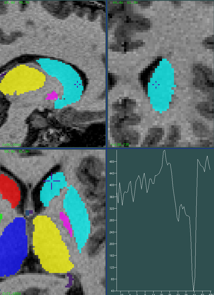 striatum 1