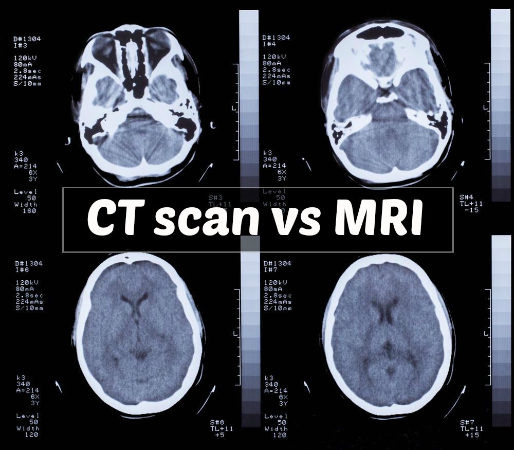 Basic MRI Workflow