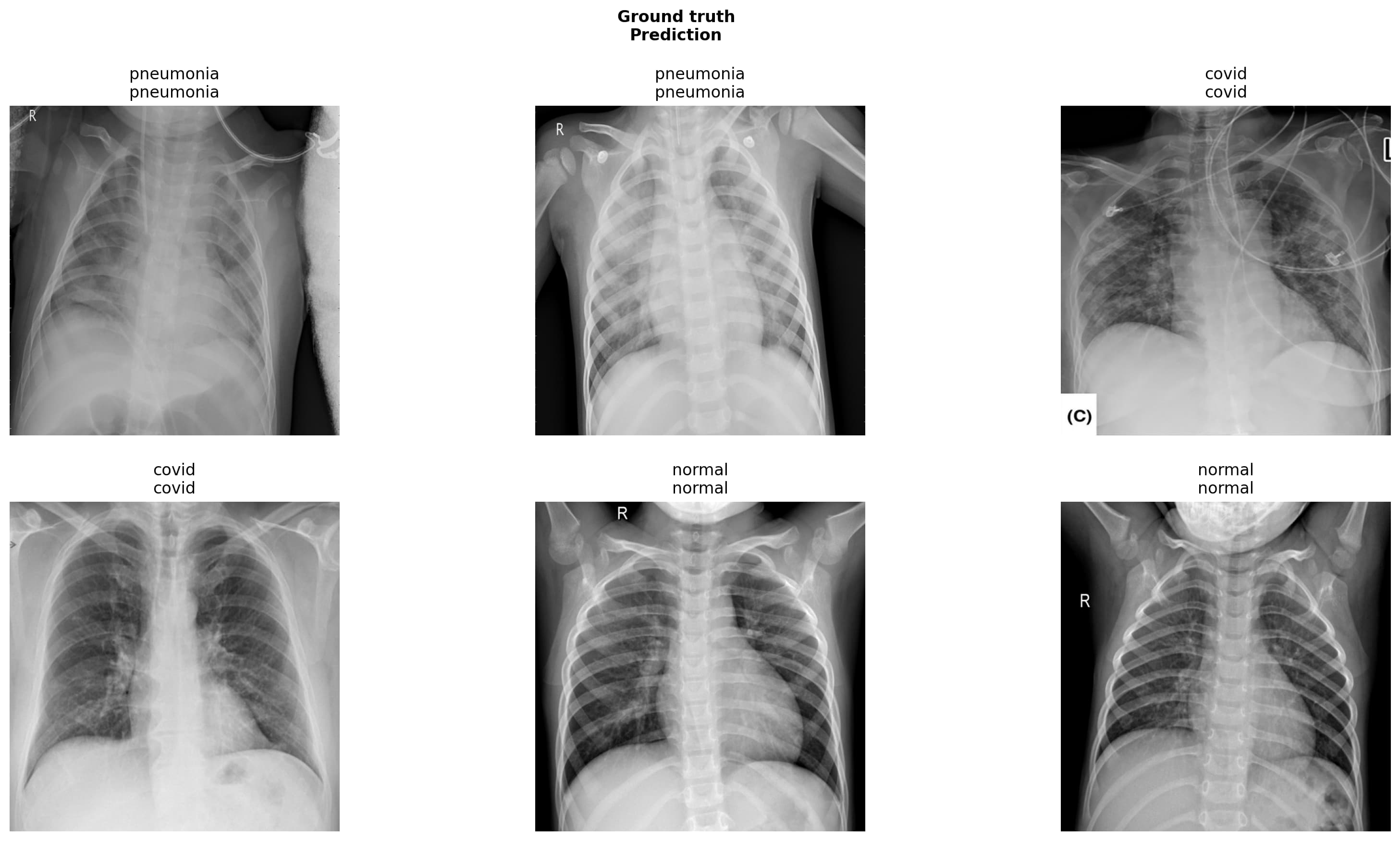 Identify COVID-19 X-rays