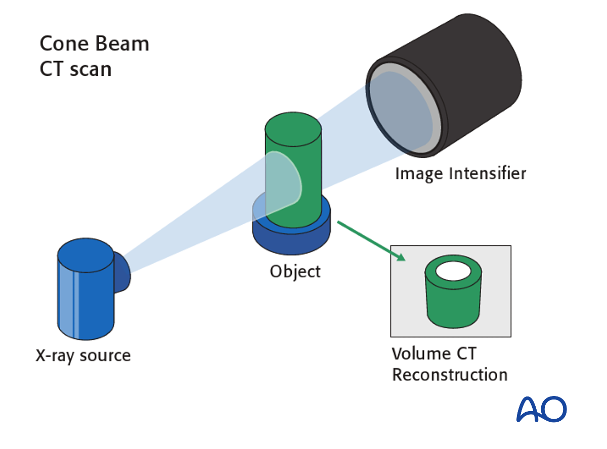 diagram of a typical cone beam setup for 3D situation