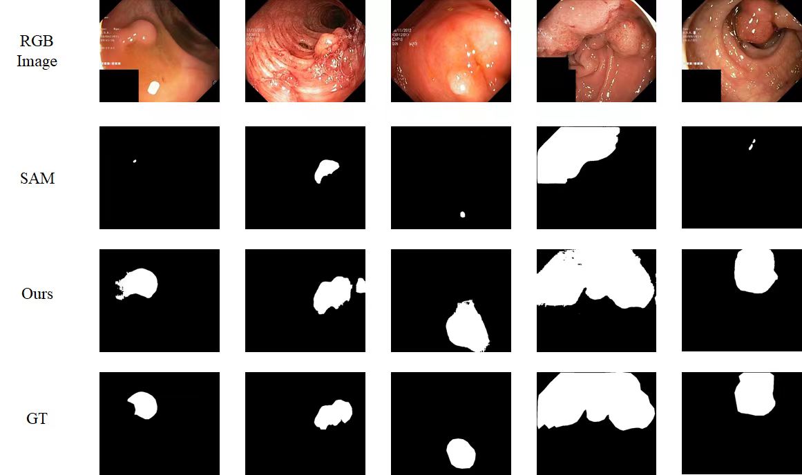 SAM-Adapter在息肉分割任务上的表现