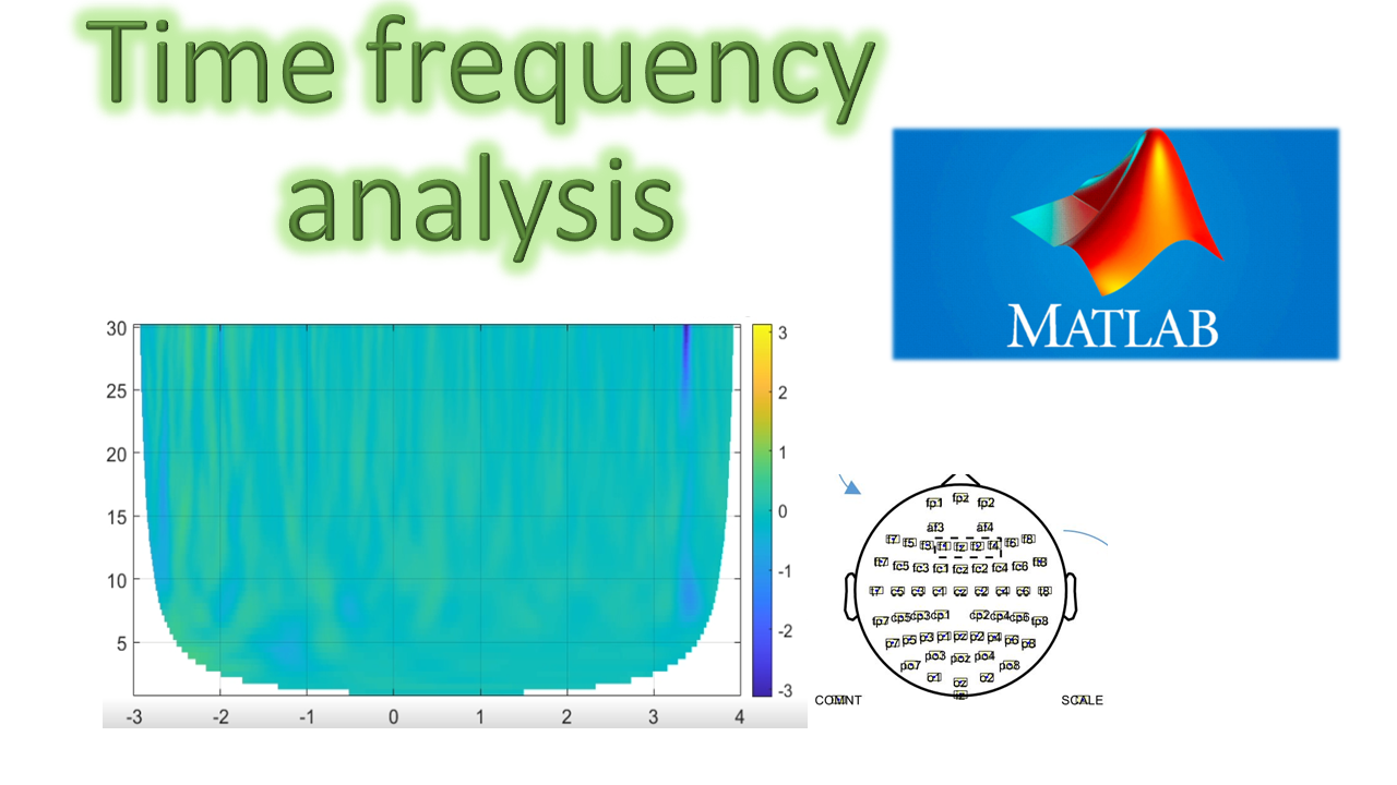 Time Frequency analysis of EEG signals (part 1)