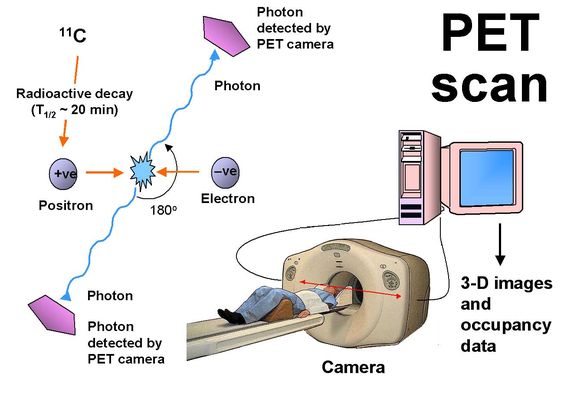 PET Scan Process