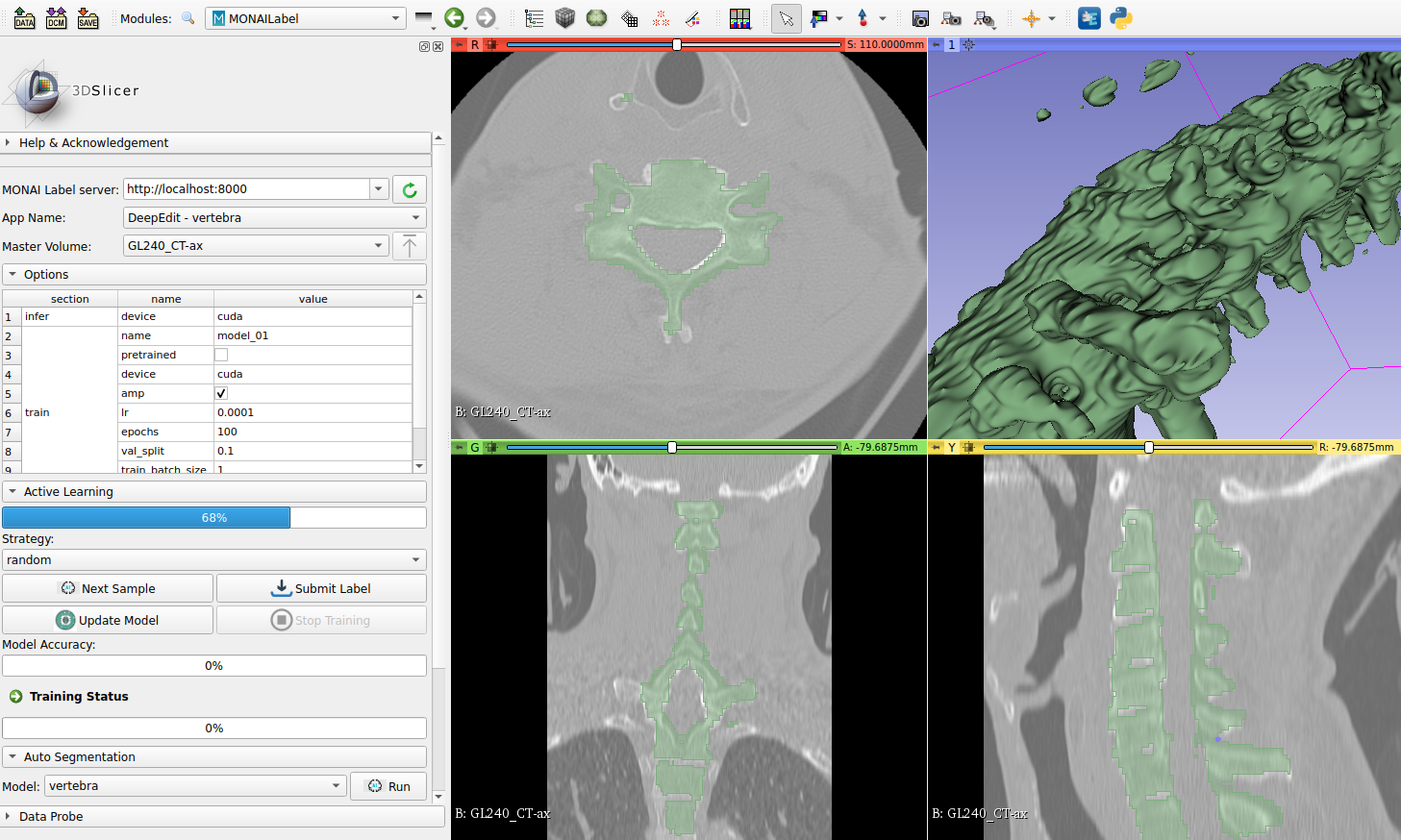 MONAILabel vertebrae app