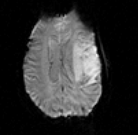 RegLib C09: fMRI to T1\ 200x195