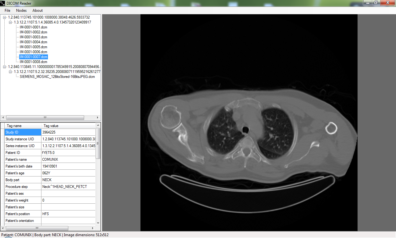 DICOM Reader screenshot