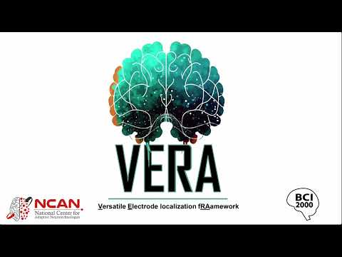 VERA Basic UseTutorial