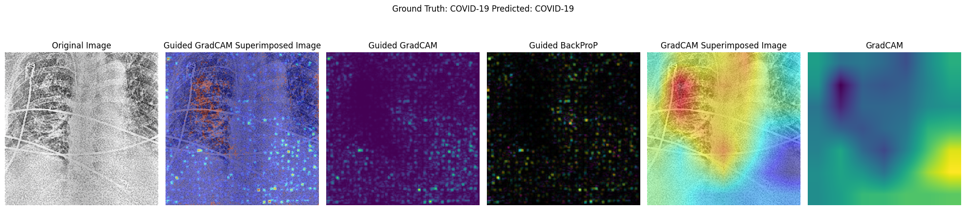 Activation Map Visualisation