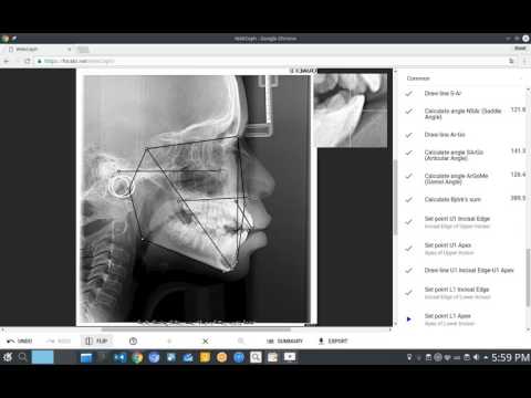 WebCeph cephaometric image tracing demo