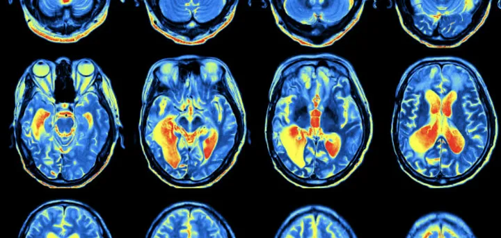 fmri