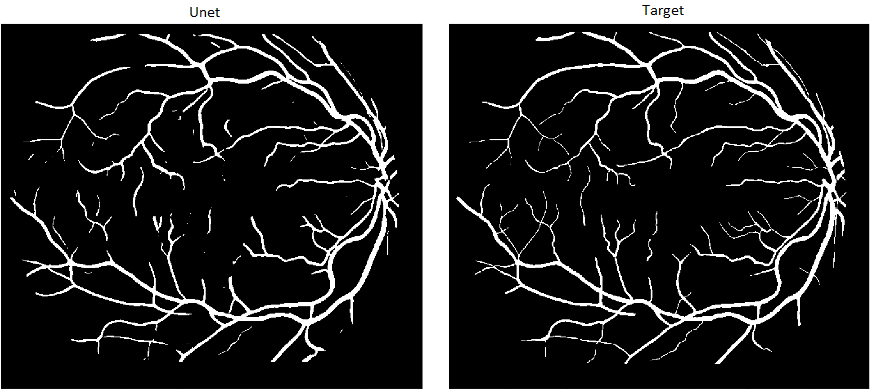 Fundus_Unet