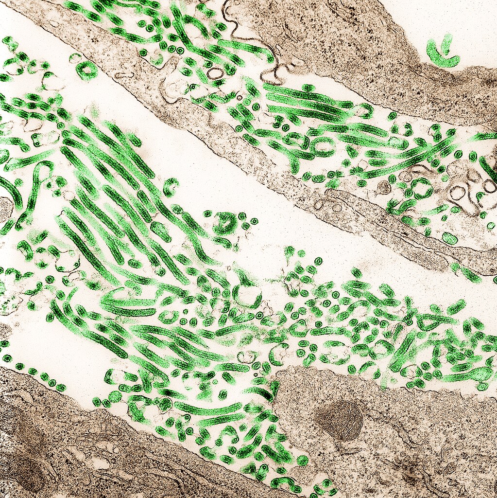 Ebola Virus particles