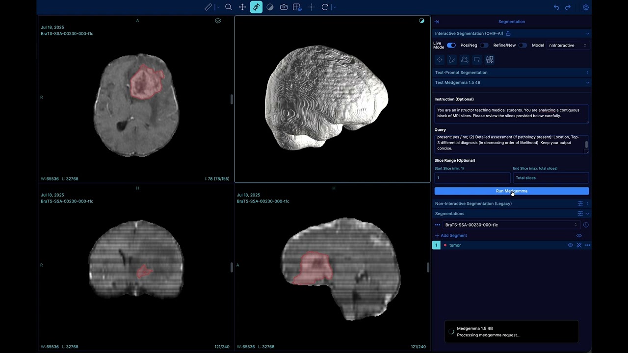 VoxTell + MedGemma Demo