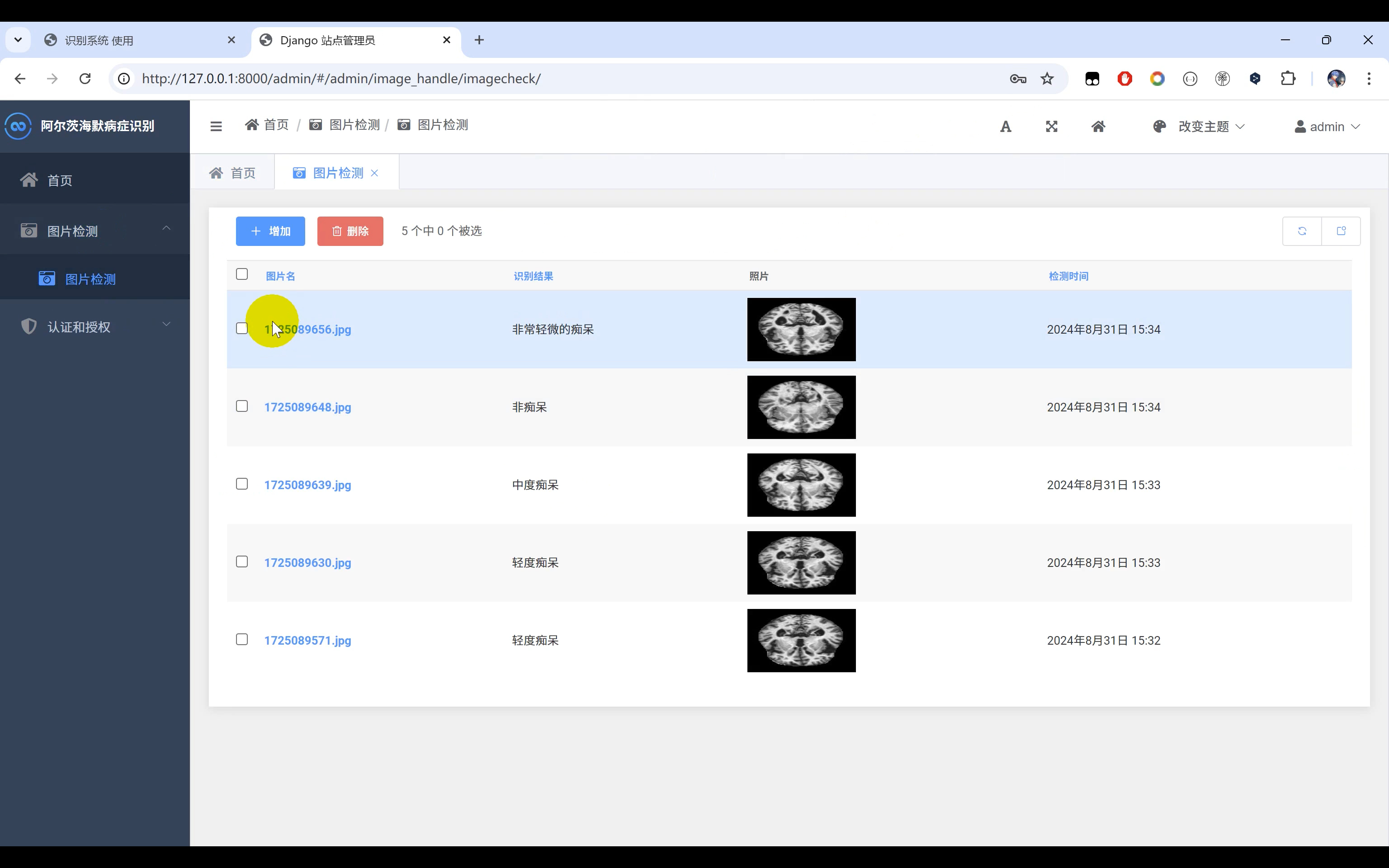 GitHub - ziwupython/aechm_check: 阿尔茨海默病症识别+图像识别Python+人工智能+深度学习 ...