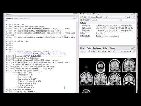 SCCAN analysis