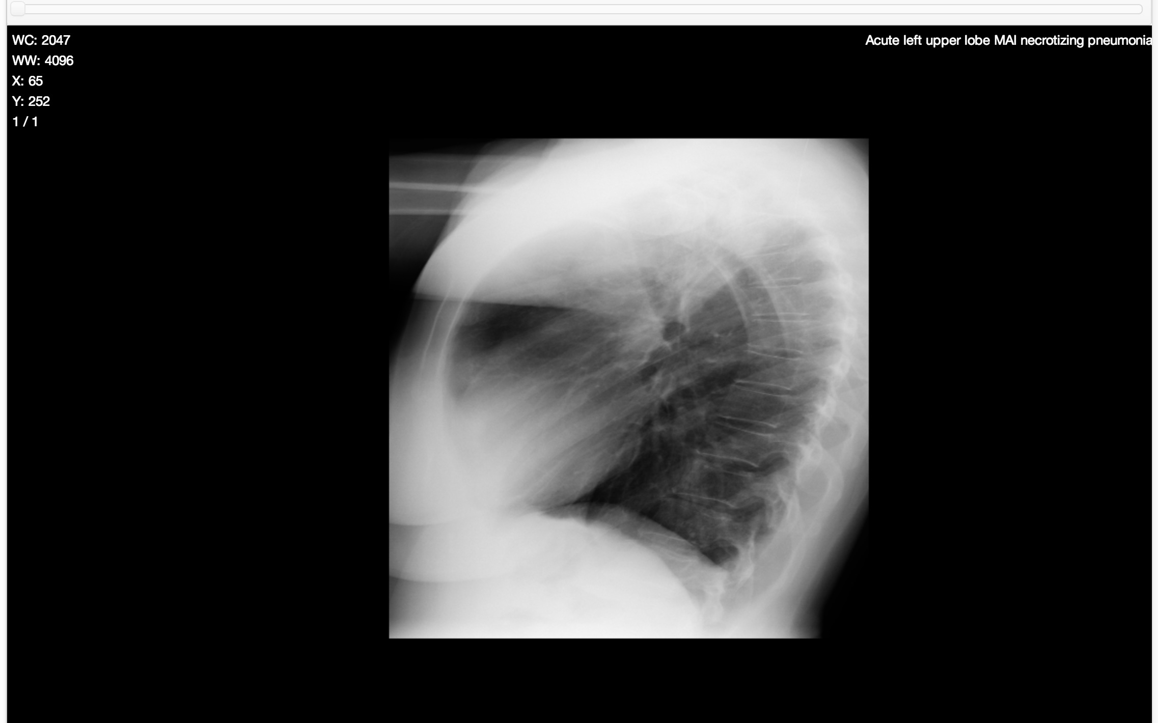 lateral radiograph