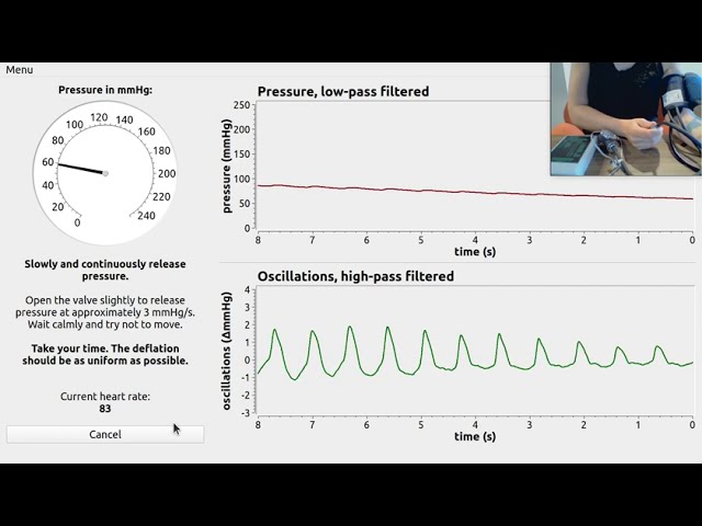 obp hardware overview.