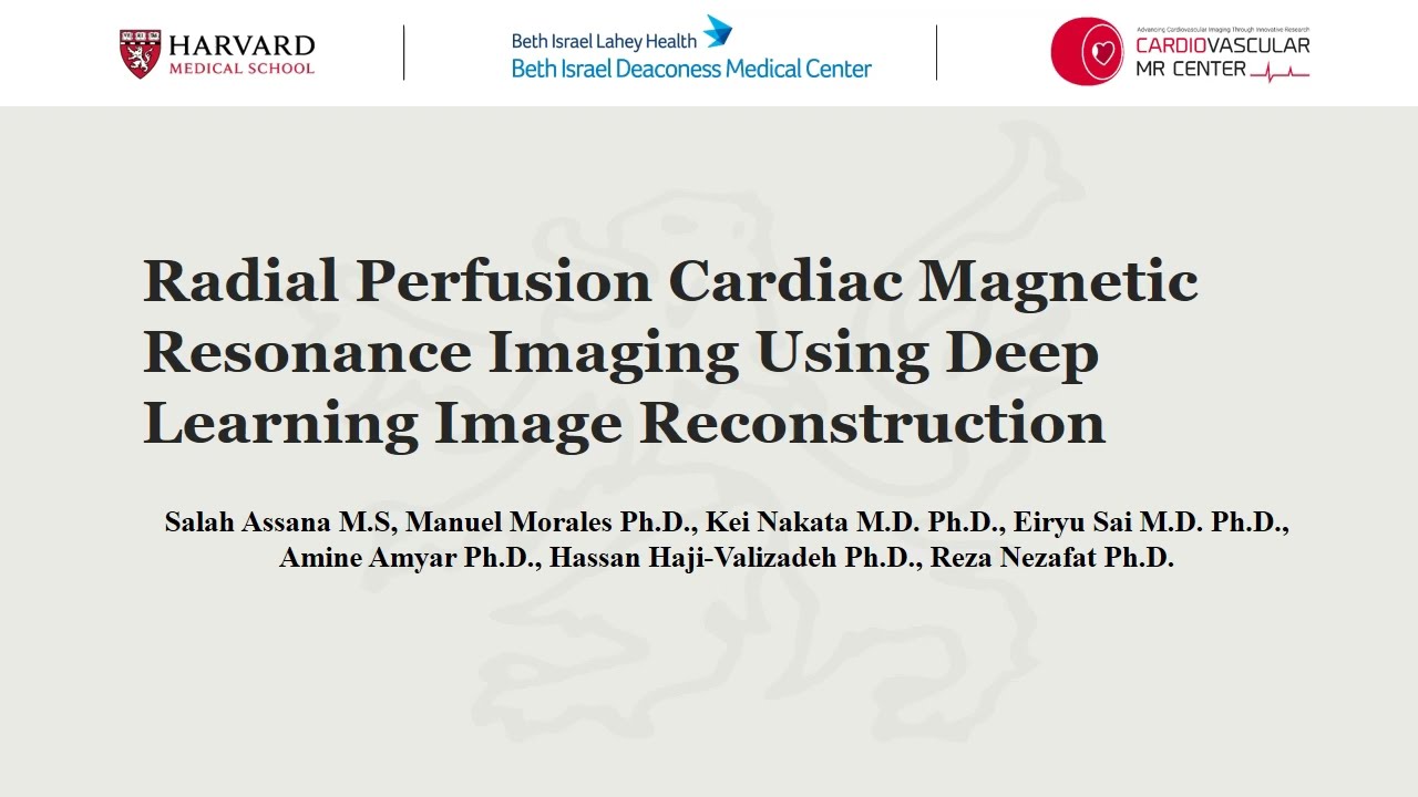 Radial Perfusion Cardiac Magnetic Resonance Imaging Using Deep Learning Image Reconstruction