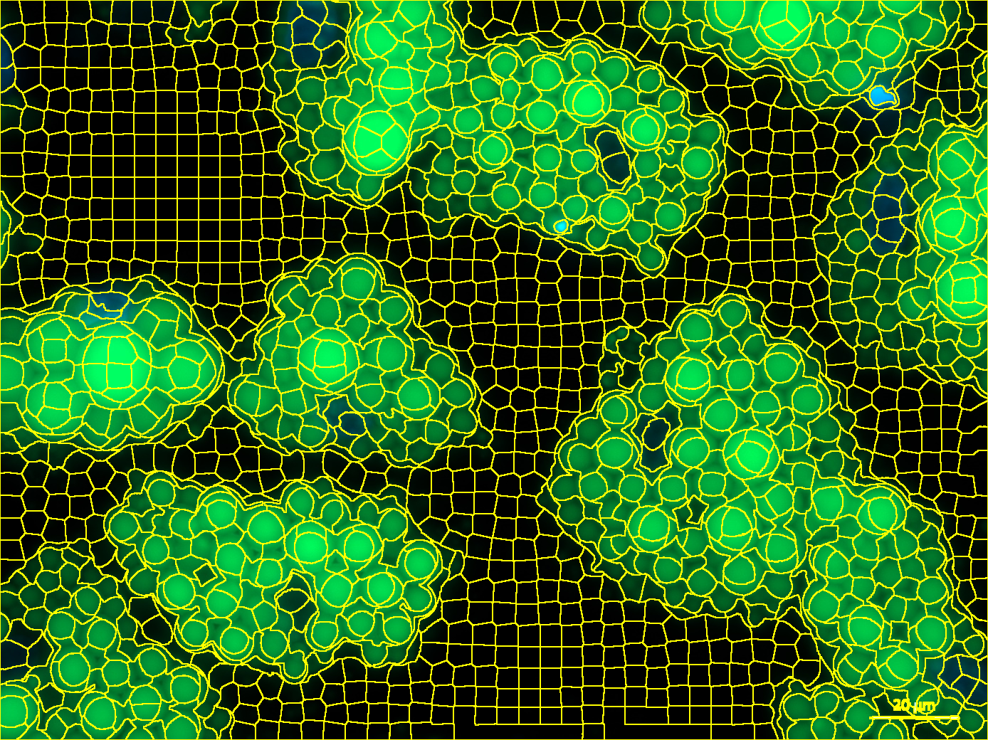 lipid-droplets.png