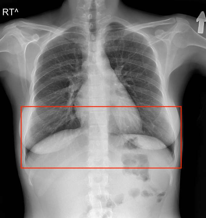 MRI Annotated