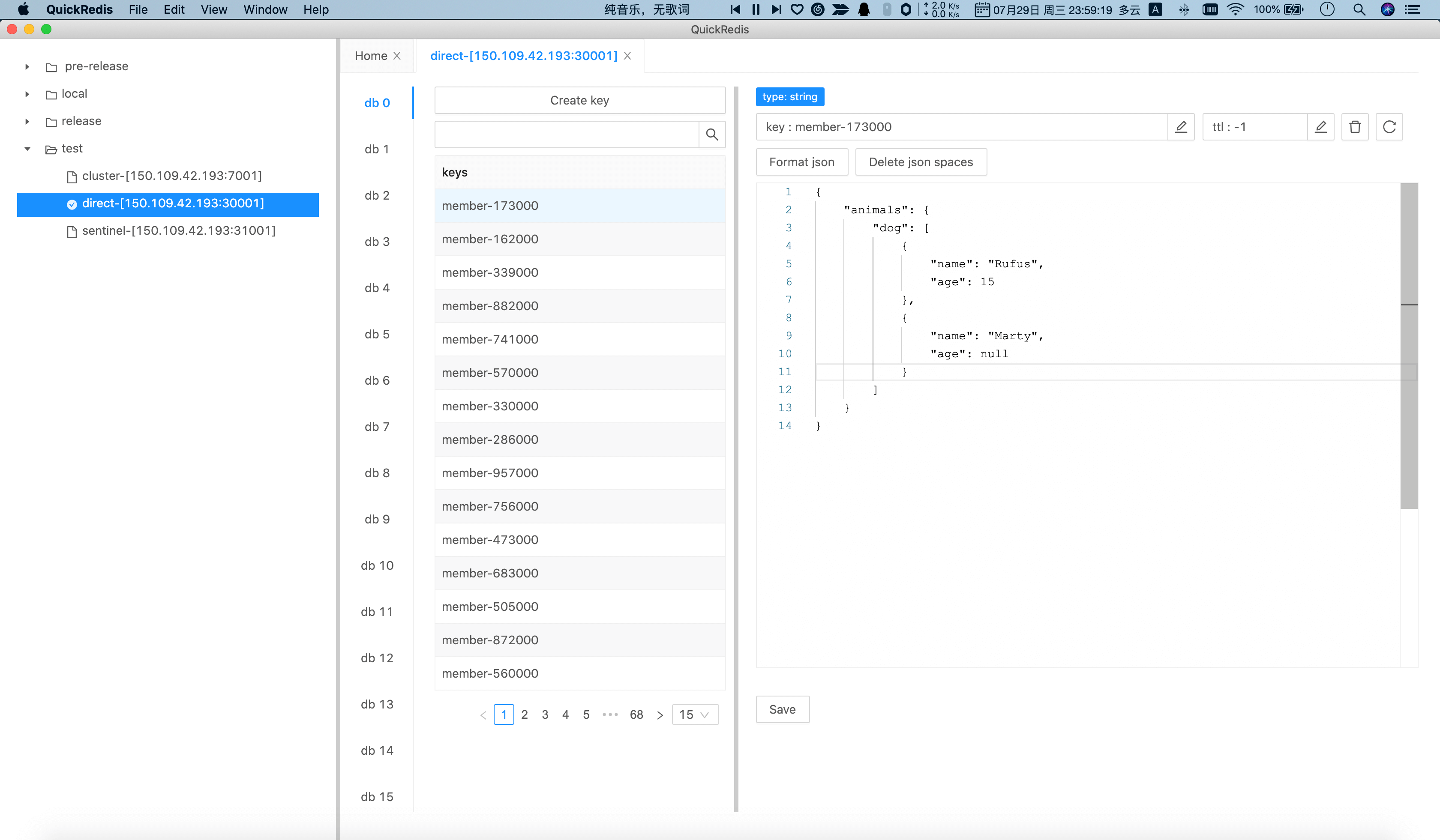 string type management