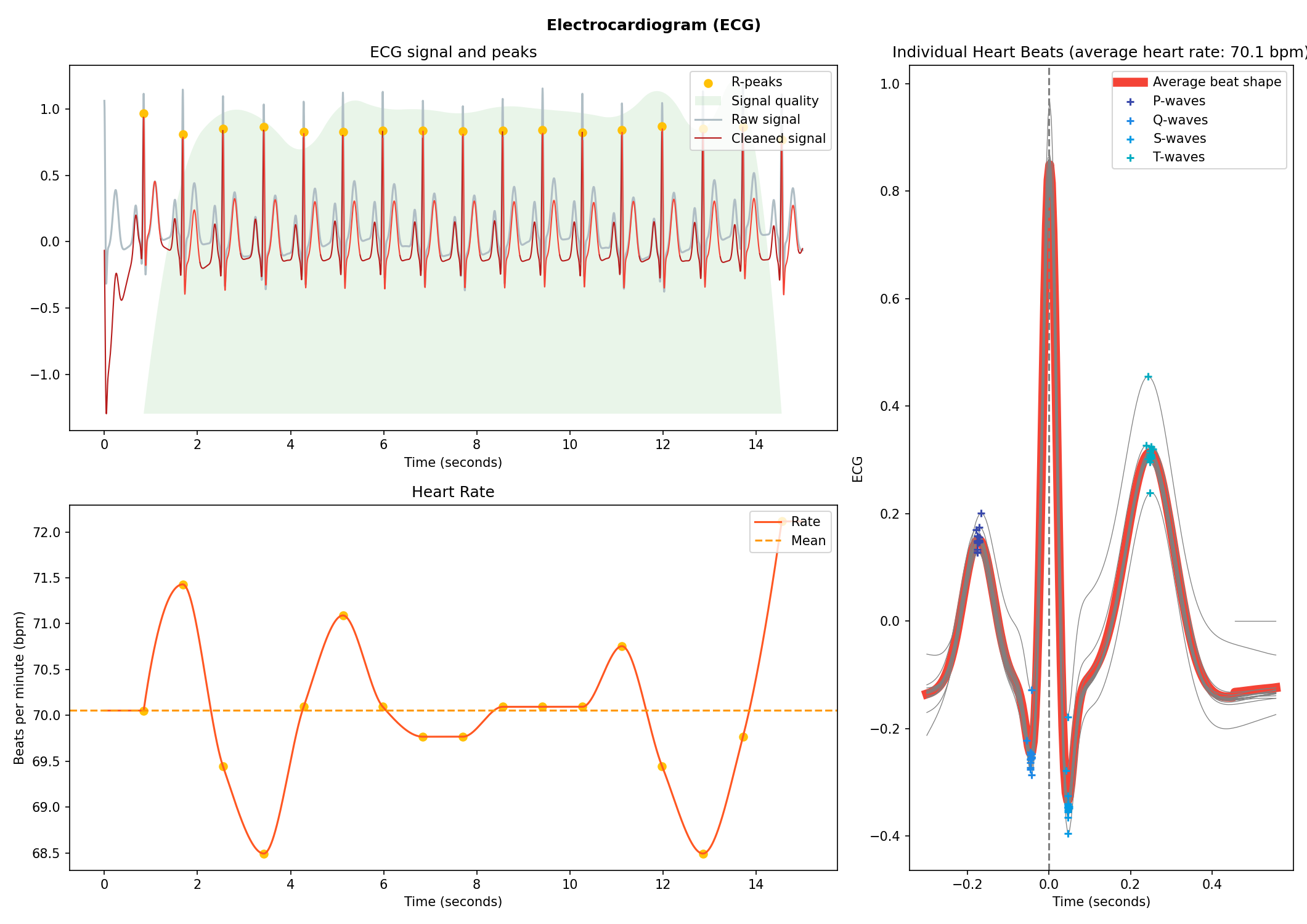 https://raw.git.luolix.top/neuropsychology/NeuroKit/master/docs/readme/README_ecg.png