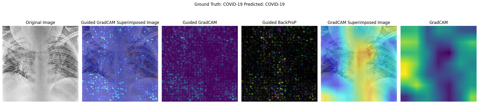 Activation Map Visualisation