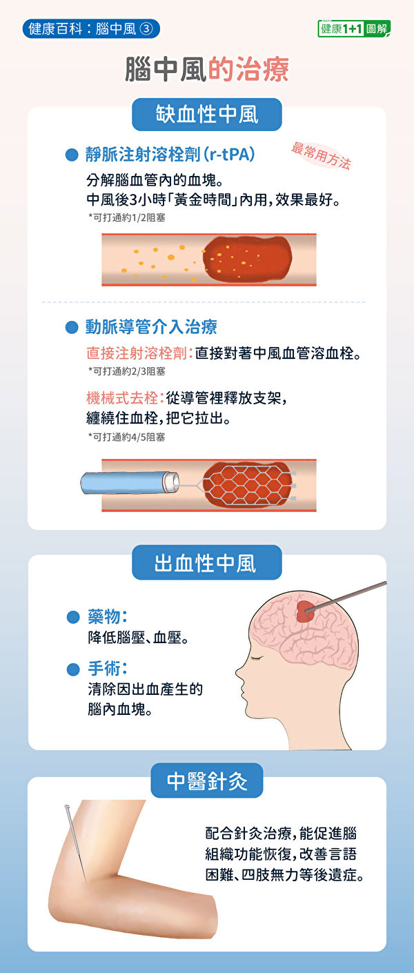 脑中风的治疗方法，其中最常见方法是注射静脉血栓溶解剂r-tPA。（健康1+1／大纪元）