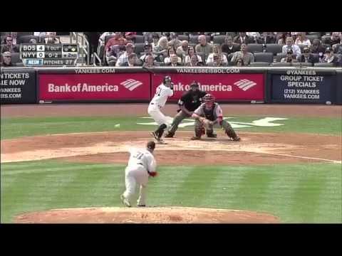 mlb1