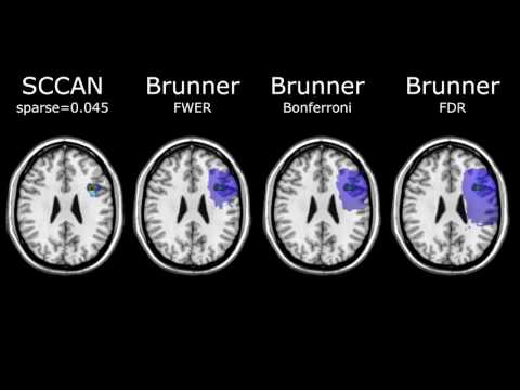 Simulation comparisons