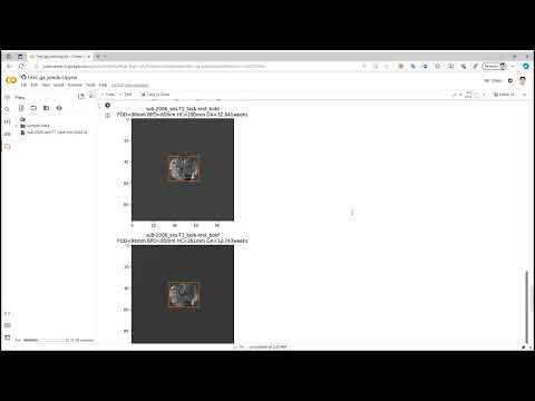 Automated TICI Scoring with DL