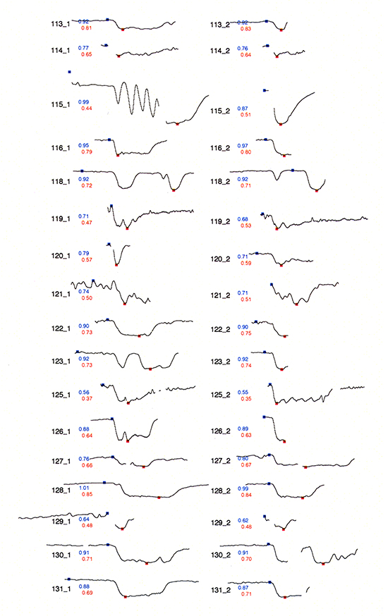 Original sparklines, source Edward Tufte.