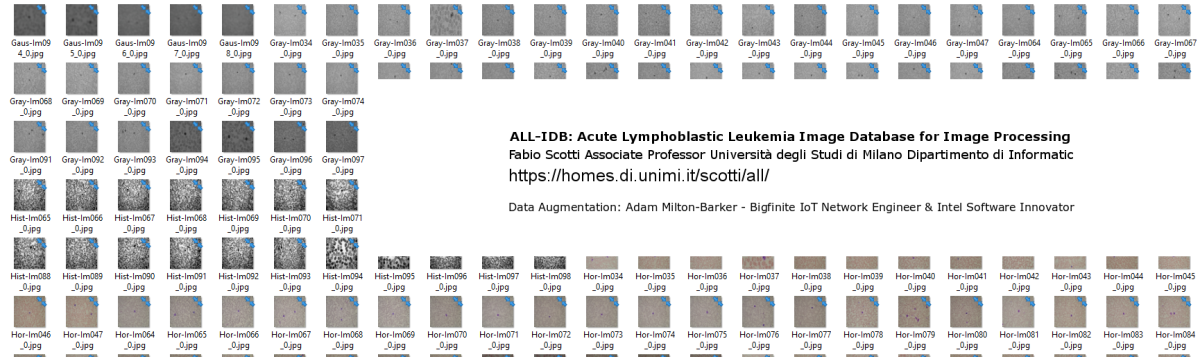 Acute Myeloid & Lymphoblastic Leukemia Classifier Data Augmentation program