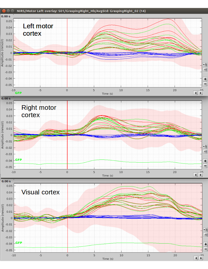 Fig. 3 Visualization of the haemodynamic response