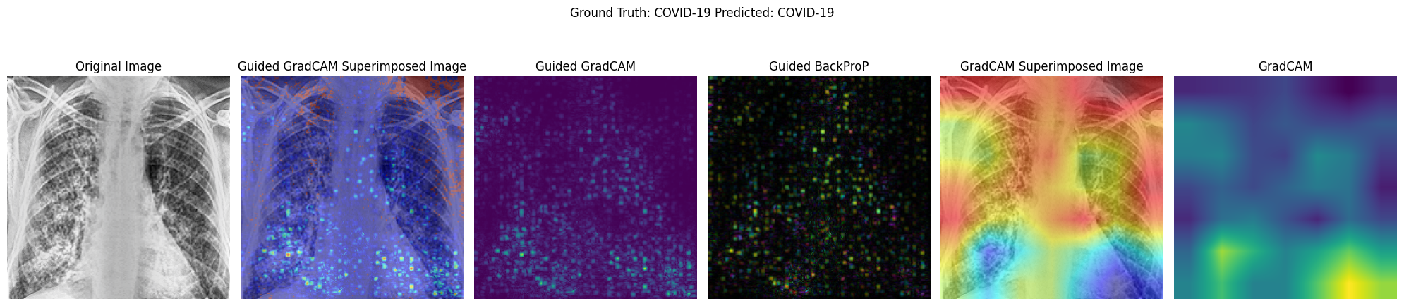 Activation Map Visualisation