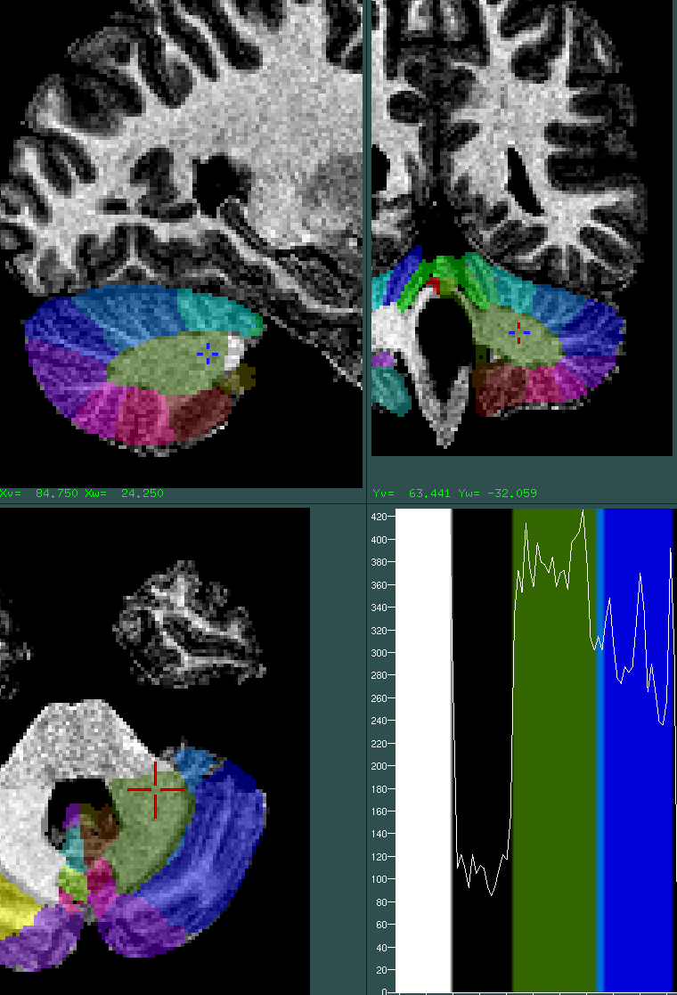 cerebellum 0.5