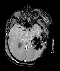 RegLib C38 Thumb5.png\ 200x236