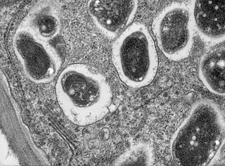 Transmission electron microscope image of a cross section though a soybean