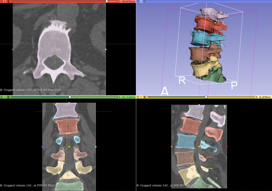 improved spine annotation