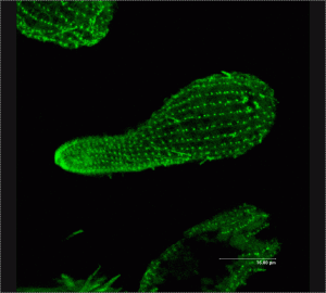 Beta-Tubulin in Tetrahymena cell, visualised using GFP-marked antibodies under a commercial confocal microscope. (Pawel Jasnos)