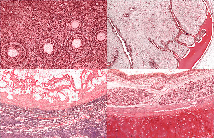 Pan Cancer from a Microscope