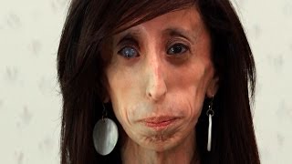 World's Thinnest Woman: Body Bizarre Episode 1