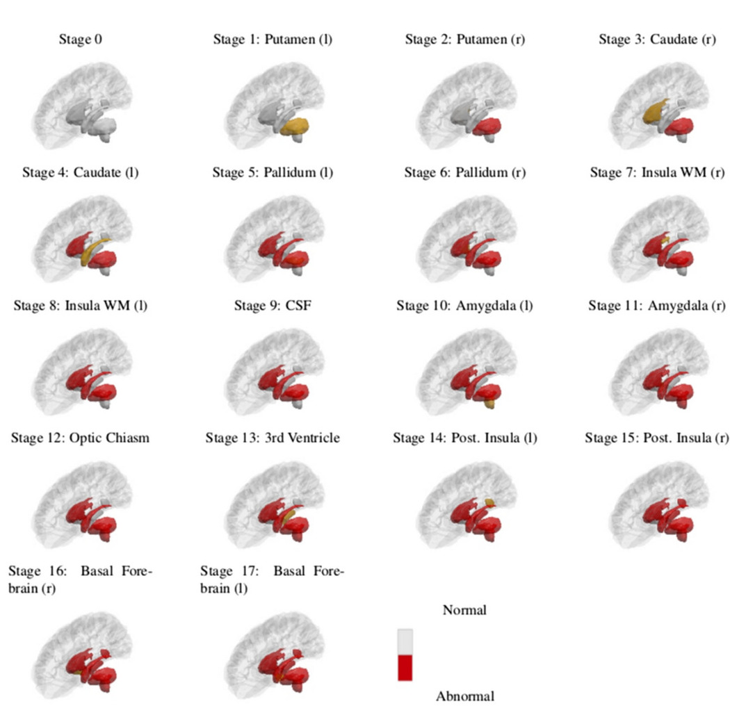 Subcortical regions used by Wijeratne et al, Ann. Clin. Neurol., 2018