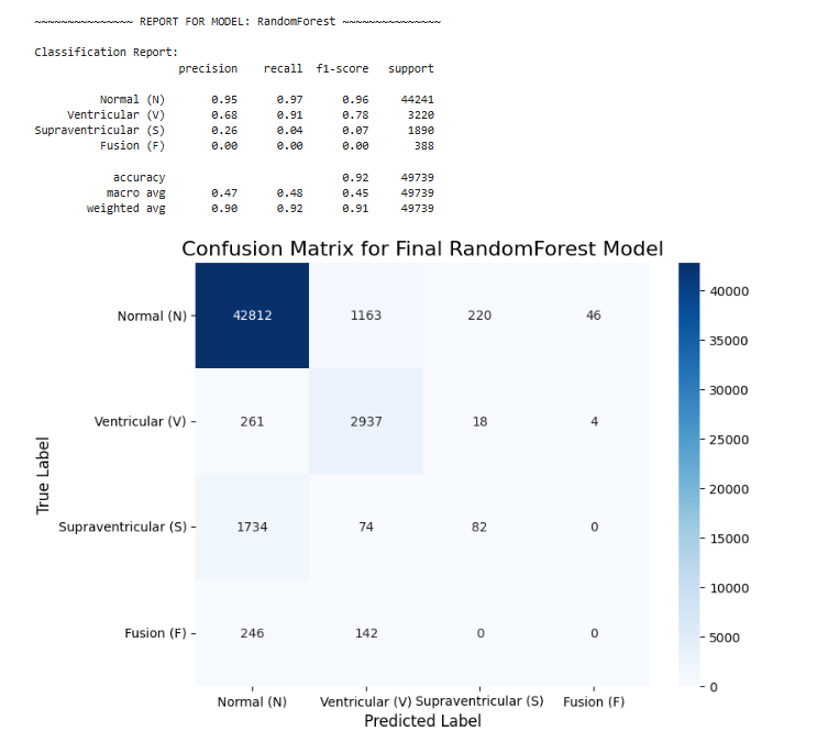 GitHub - Sundsturm/ahdc-machine-learning: Arrhythmia Holter Detection ...